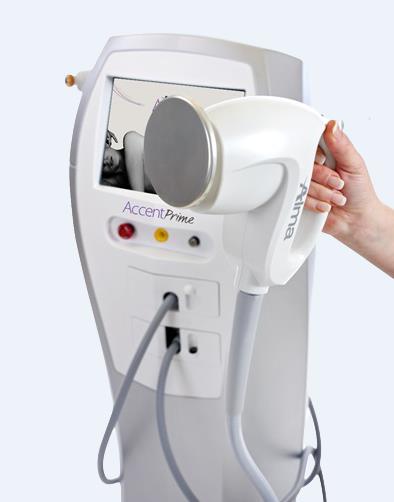 Aparaty do redukcji cellulitu i modelowania sylwetki Alma Lasers Accent Prime