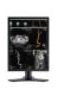 Monitory medyczne NEC MD213MC
