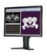 Monitory medyczne NEC MDview 202