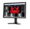 Monitory medyczne NEC MDview 242-2