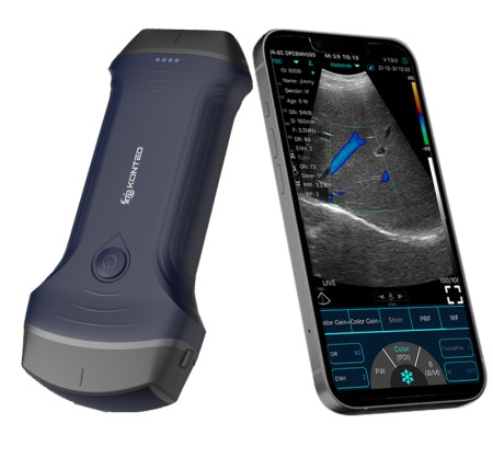 Ultrasonografy kieszonkowe ręczne (USG) Konted C10RL PRO