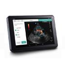 Ultrasonografy kieszonkowe ręczne (USG) SonoSite iViz