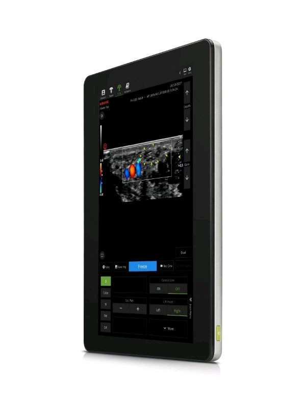 Ultrasonografy kieszonkowe ręczne (USG) Wisonic Piloter
