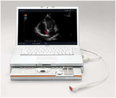 Ultrasonografy mobilne przyłóżkowe ALOKA Aloka ProSound C3cv