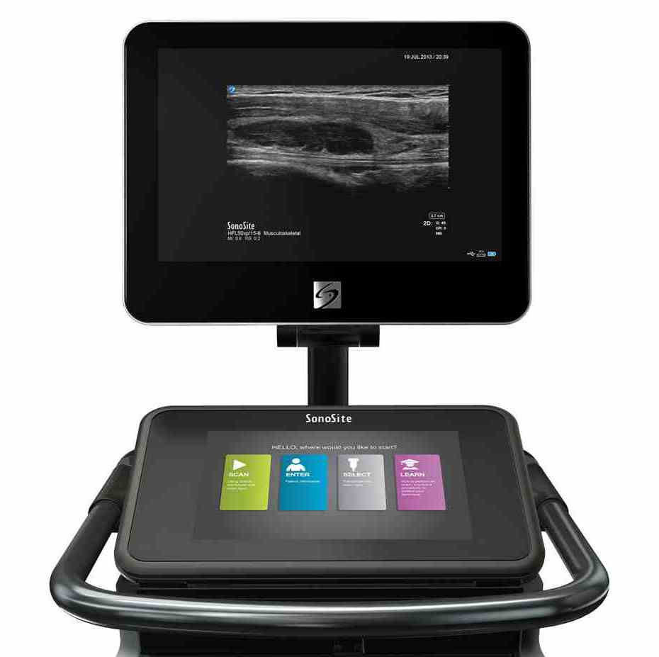 Ultrasonografy mobilne przyłóżkowe SonoSite X-Porte