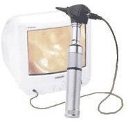 Videootoskopy Welch Allyn CompacVideo z rękojeścią akumulatorową