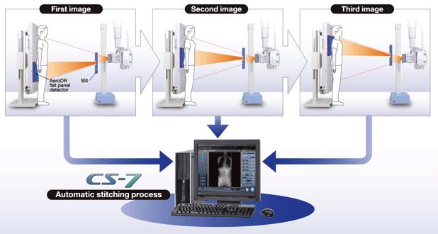 Detektory RTG cyfrowe Konica Minolta AeroDR Auto-stitching System