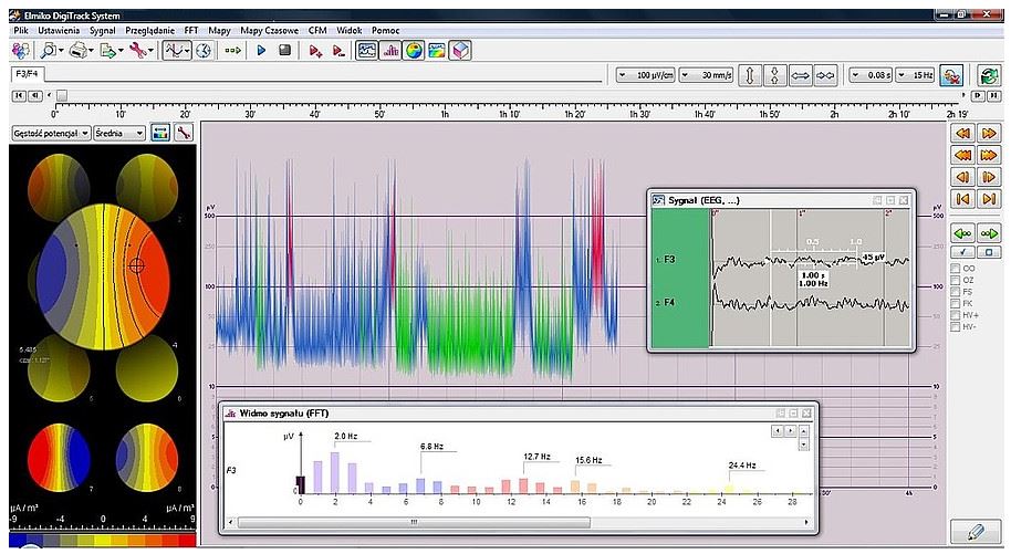 Elektroencefalografy (EEG) ELMIKO DigiTrack CCFM