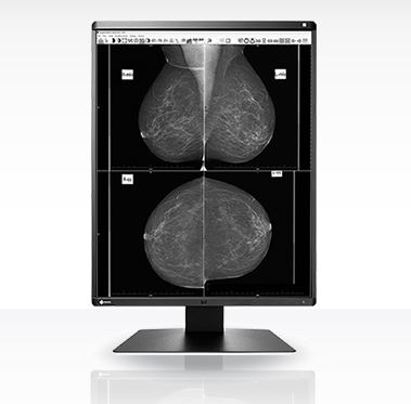 Monitory medyczne Eizo RadiForce GX560