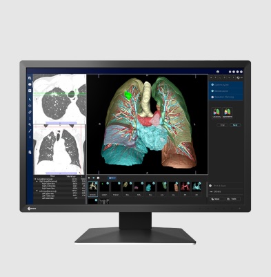 Monitory medyczne Eizo RadiForce MX243W