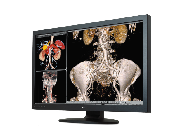 Monitory medyczne JVC TOTOKU CCL650i2