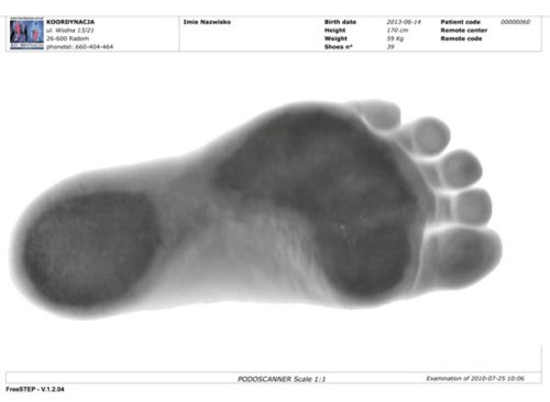 Podoskopy Sensor Medica Podoscan 2D FootCAD