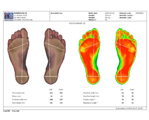 Podoskopy Sensor Medica Podoscan 2D FootCAD