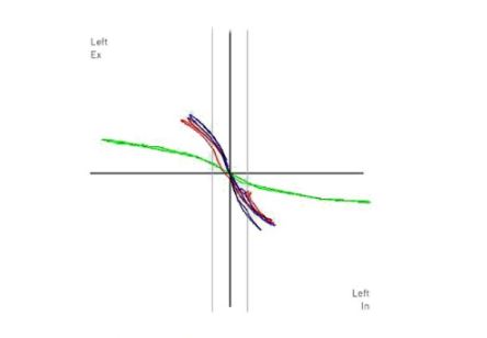 Rynomanometry Rhinolab 4RHINO
