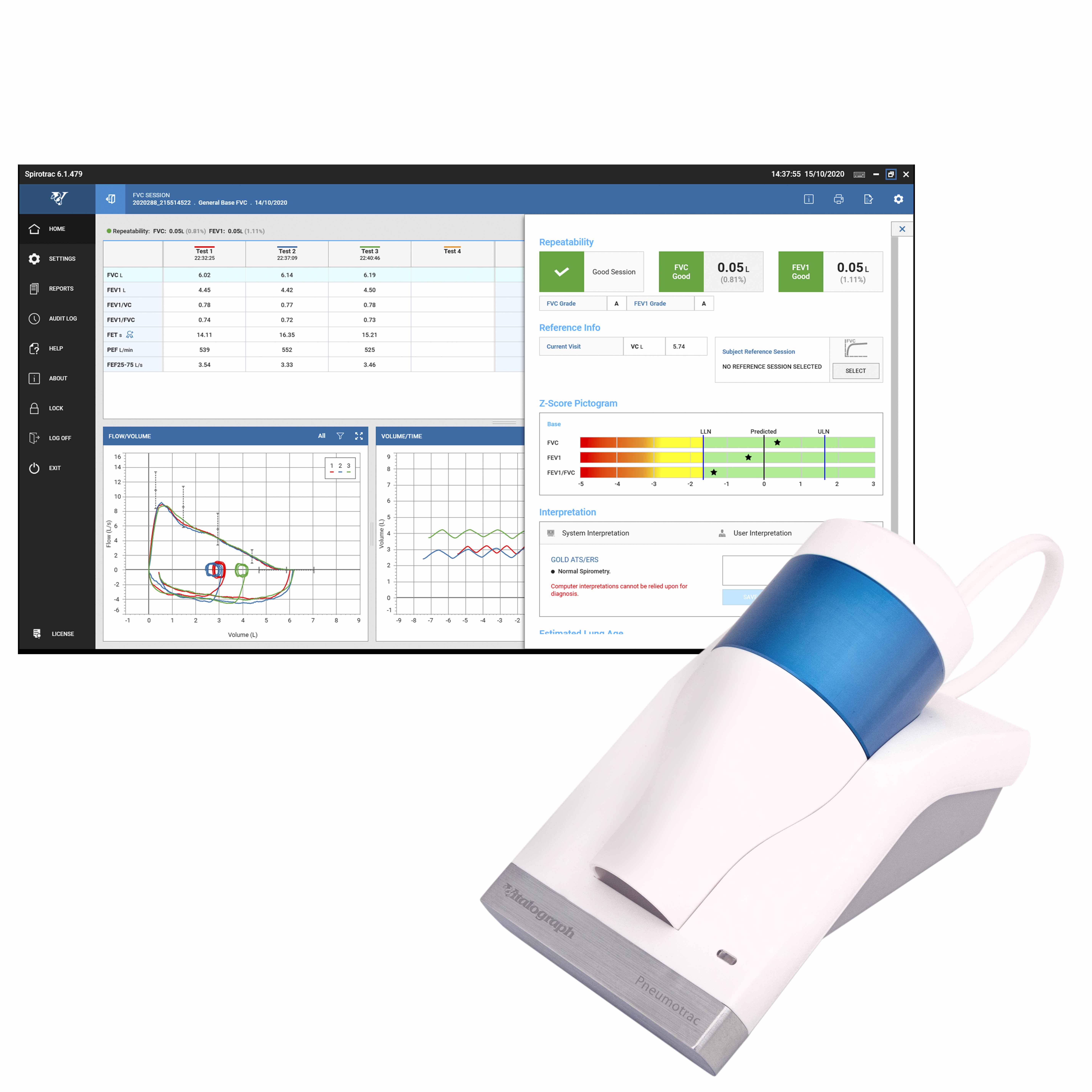 Spirometry Vitalograph Pneumotrac