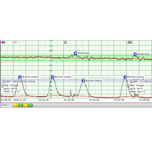 Systemy monitoringu położniczego KTG EDAN FTS-6