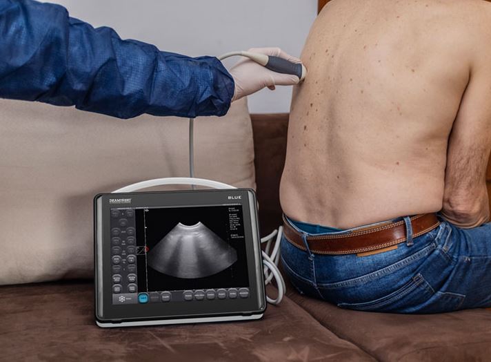 Ultrasonografy kieszonkowe ręczne (USG) DRAMIŃSKI BLUE