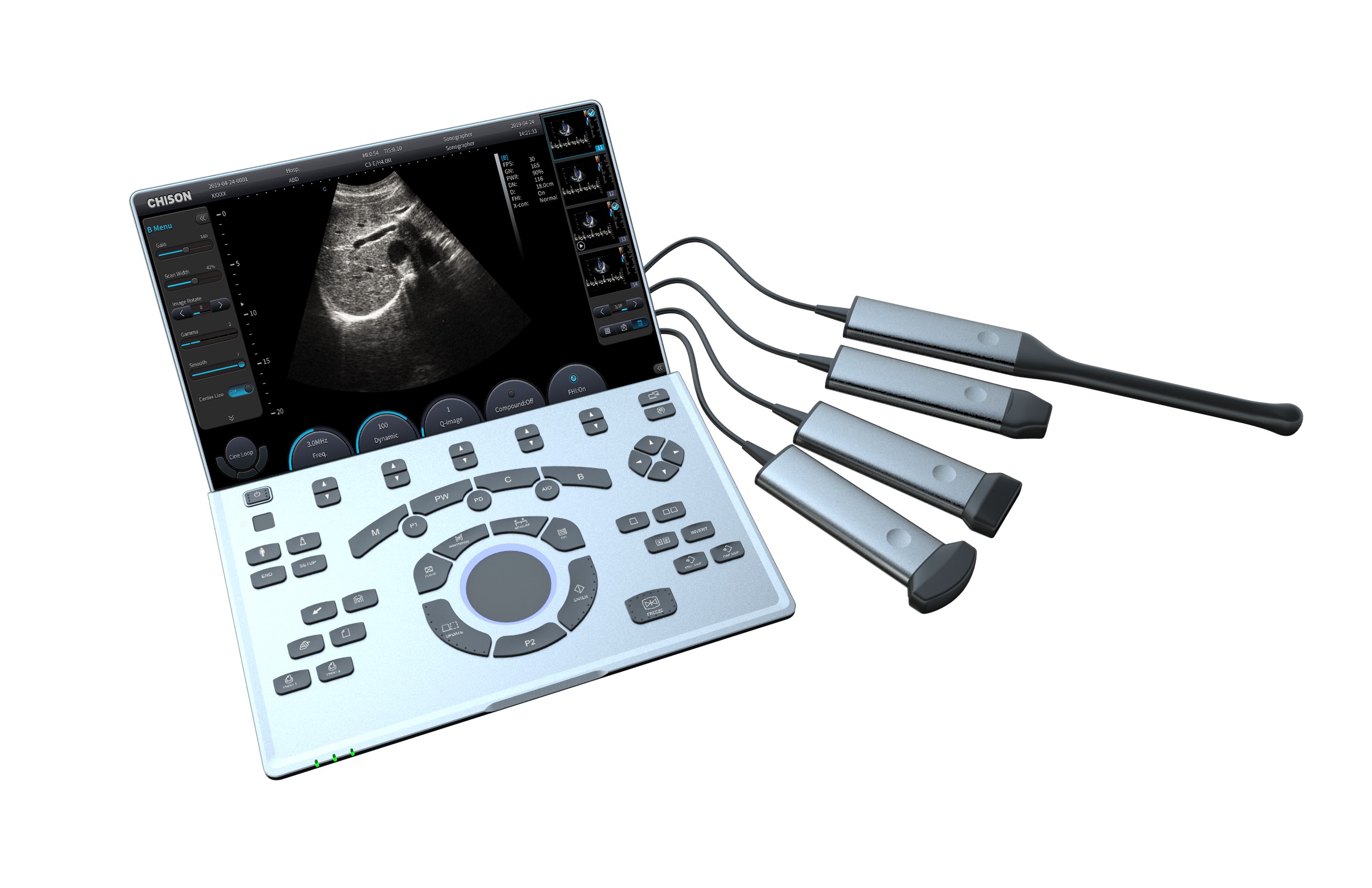 Ultrasonografy mobilne przyłóżkowe CHISON SonoAIR