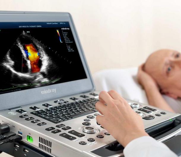 Ultrasonografy mobilne przyłóżkowe MINDRAY M9