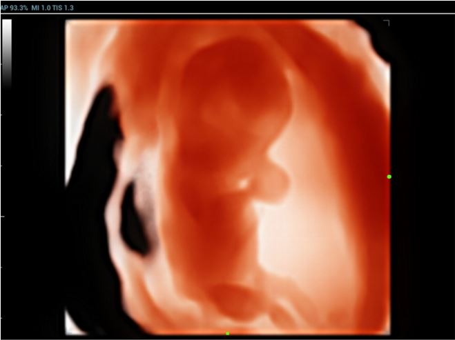 Ultrasonografy stacjonarne wielonarządowe - USG MINDRAY Resona 7