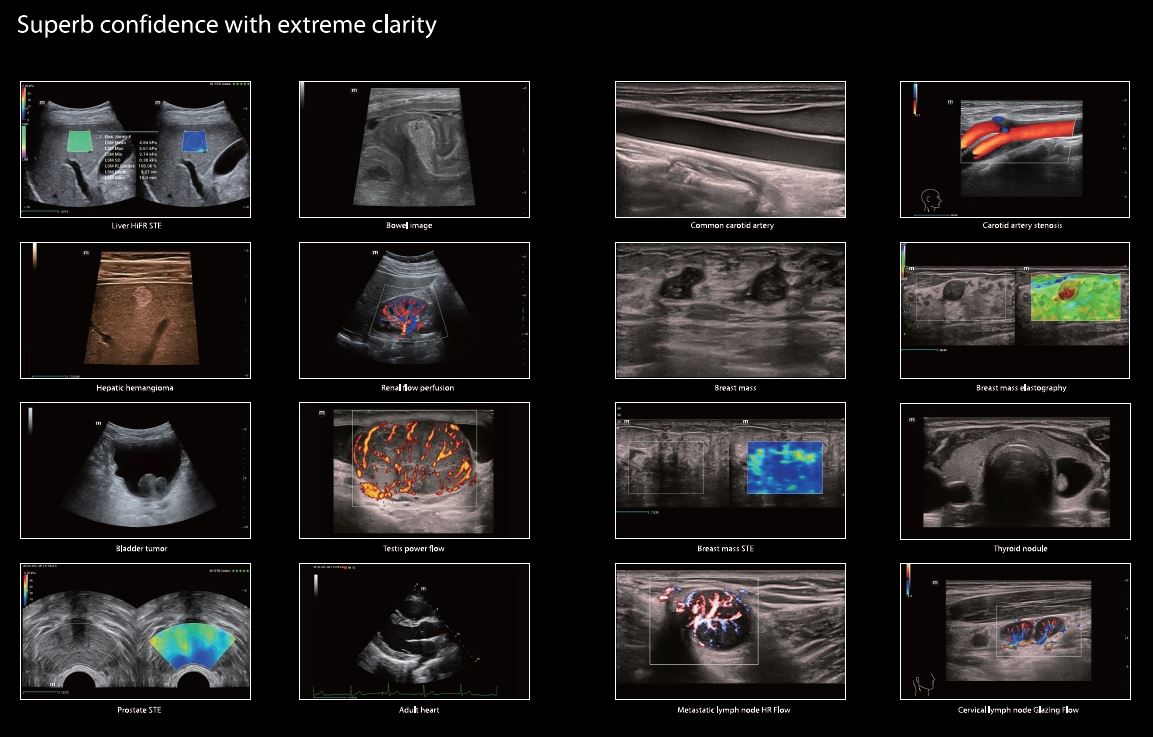 Ultrasonografy stacjonarne wielonarządowe - USG MINDRAY Resona I9