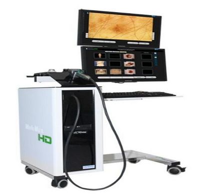 Videodermatoskopy