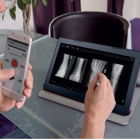 Stacje diagnostyczne mobilne obrazów medycznych